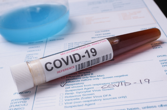 California Guidance for COVID-19 Vaccination and Testing Requirements