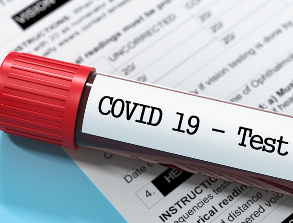 Coronavirus: Orange County Reported 3,091 New Cases and 11 More Deaths, May 31 to June 3